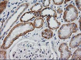 Beta-catenin Antibody in Immunohistochemistry (Paraffin) (IHC (P))