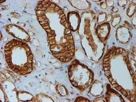 Beta-catenin Antibody in Immunohistochemistry (Paraffin) (IHC (P))