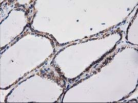 Beta-catenin Antibody in Immunohistochemistry (Paraffin) (IHC (P))