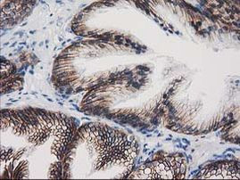 Beta-catenin Antibody in Immunohistochemistry (Paraffin) (IHC (P))