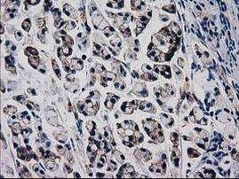 Beta-catenin Antibody in Immunohistochemistry (Paraffin) (IHC (P))