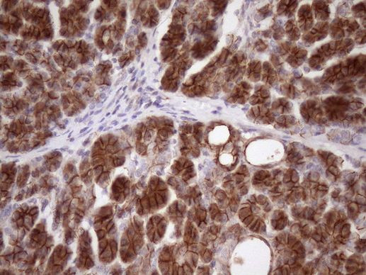 Beta-catenin Antibody in Immunohistochemistry (Paraffin) (IHC (P))