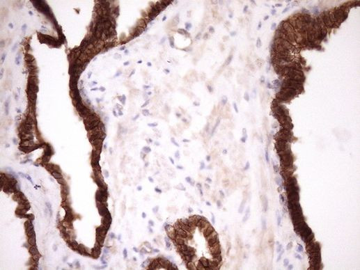 Beta-catenin Antibody in Immunohistochemistry (Paraffin) (IHC (P))