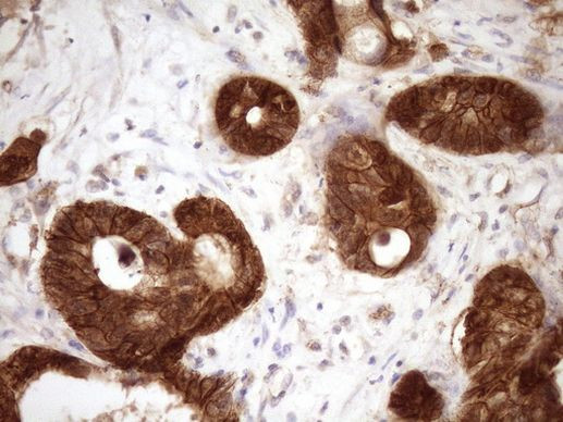 Beta-catenin Antibody in Immunohistochemistry (Paraffin) (IHC (P))