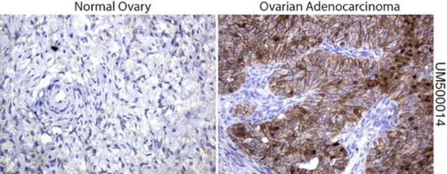 Beta-catenin Antibody in Immunohistochemistry (Paraffin) (IHC (P))