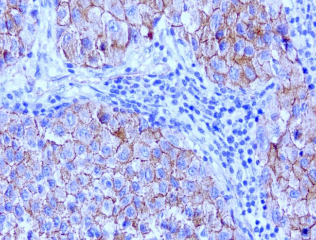 Beta-catenin Antibody in Immunohistochemistry (Paraffin) (IHC (P))