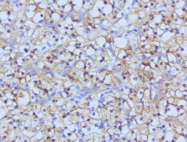 Beta-catenin Antibody in Immunohistochemistry (Paraffin) (IHC (P))