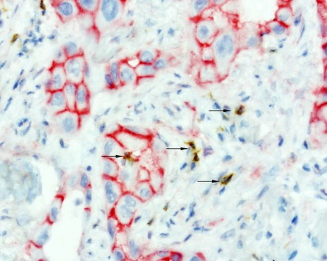 Beta-catenin Antibody in Immunohistochemistry (Paraffin) (IHC (P))