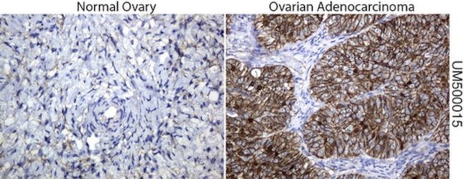 Beta-catenin Antibody in Immunohistochemistry (Paraffin) (IHC (P))