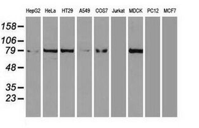 Beta-catenin Antibody in Western Blot (WB)