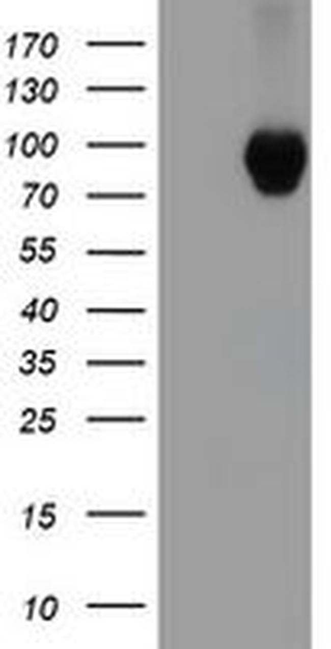 Beta-catenin Antibody in Western Blot (WB)