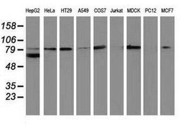 Beta-catenin Antibody in Western Blot (WB)