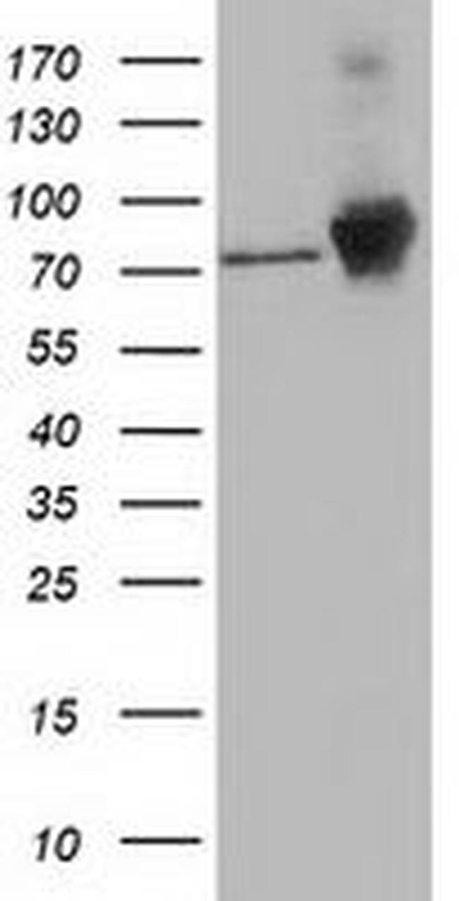 Beta-catenin Antibody in Western Blot (WB)