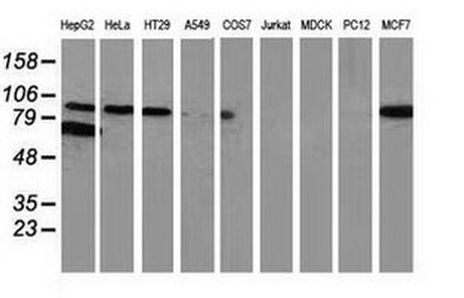 Beta-catenin Antibody in Western Blot (WB)