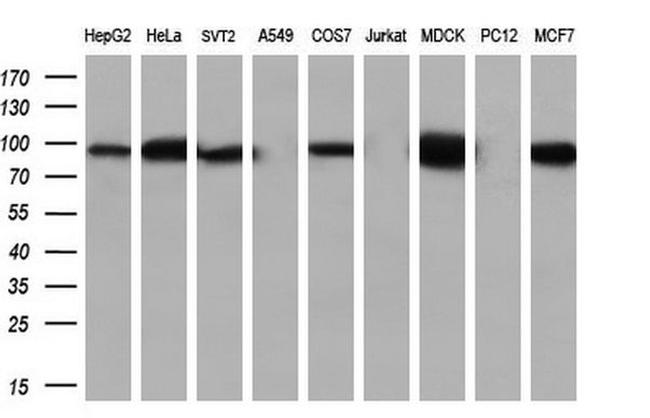 Beta-catenin Antibody in Western Blot (WB)