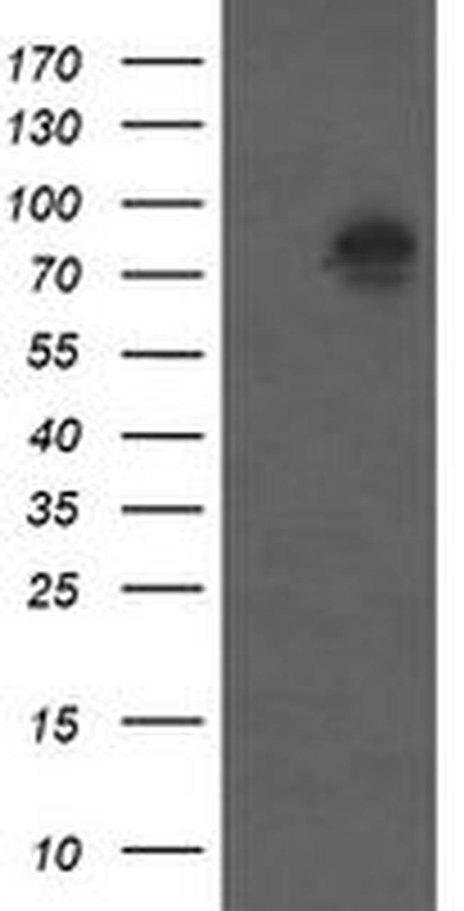 Beta-catenin Antibody in Western Blot (WB)