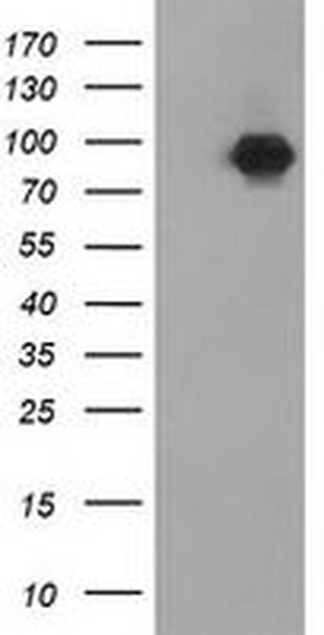 Beta-catenin Antibody in Western Blot (WB)