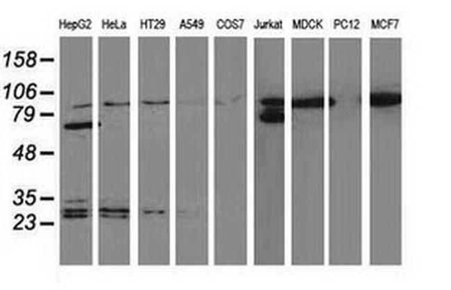 Beta-catenin Antibody in Western Blot (WB)