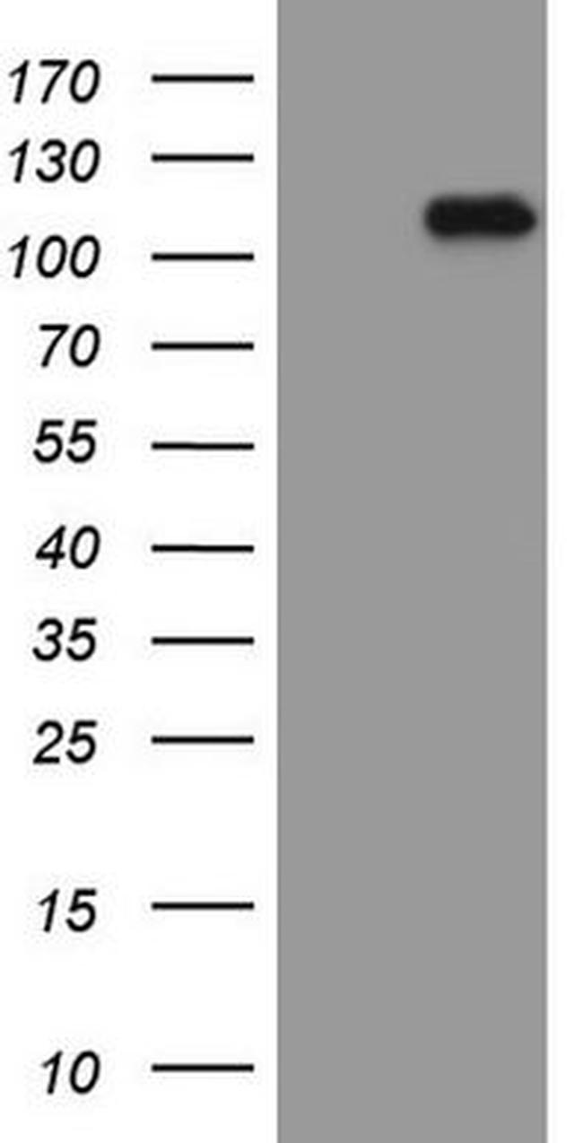 Beta-catenin Antibody in Western Blot (WB)