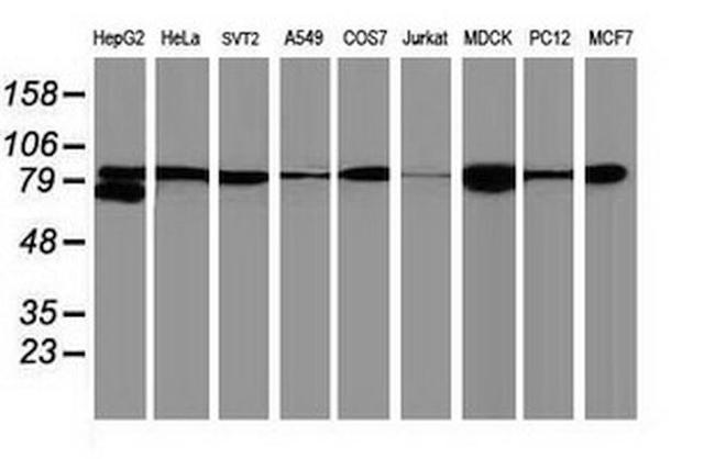 Beta-catenin Antibody in Western Blot (WB)