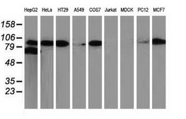 Beta-catenin Antibody in Western Blot (WB)