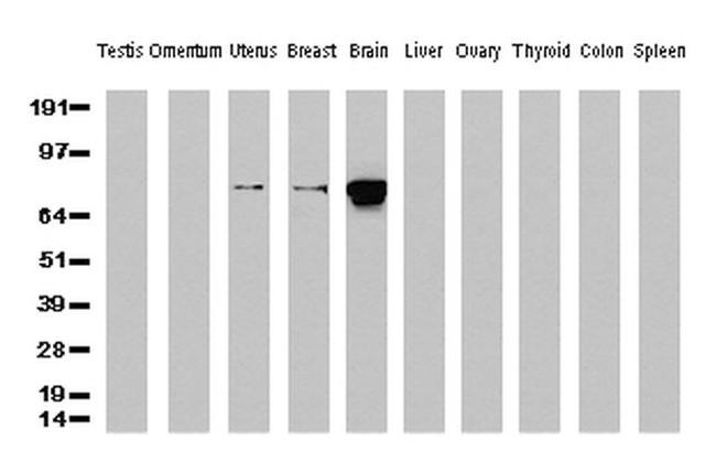 Beta-catenin Antibody in Western Blot (WB)