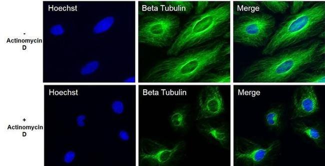 beta Tubulin Loading Control Antibody