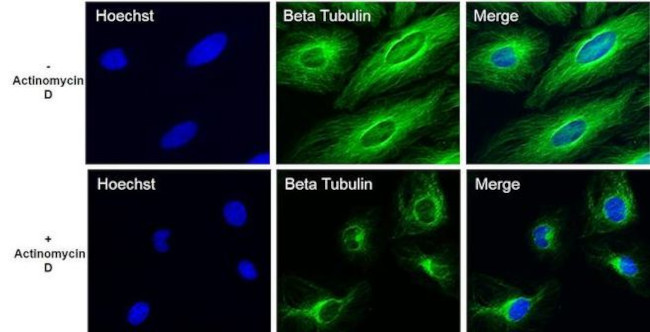 beta Tubulin Loading Control Antibody in Immunocytochemistry (ICC/IF)