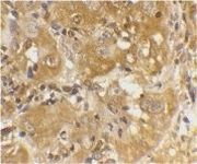 Bim Antibody in Immunohistochemistry (Paraffin) (IHC (P))