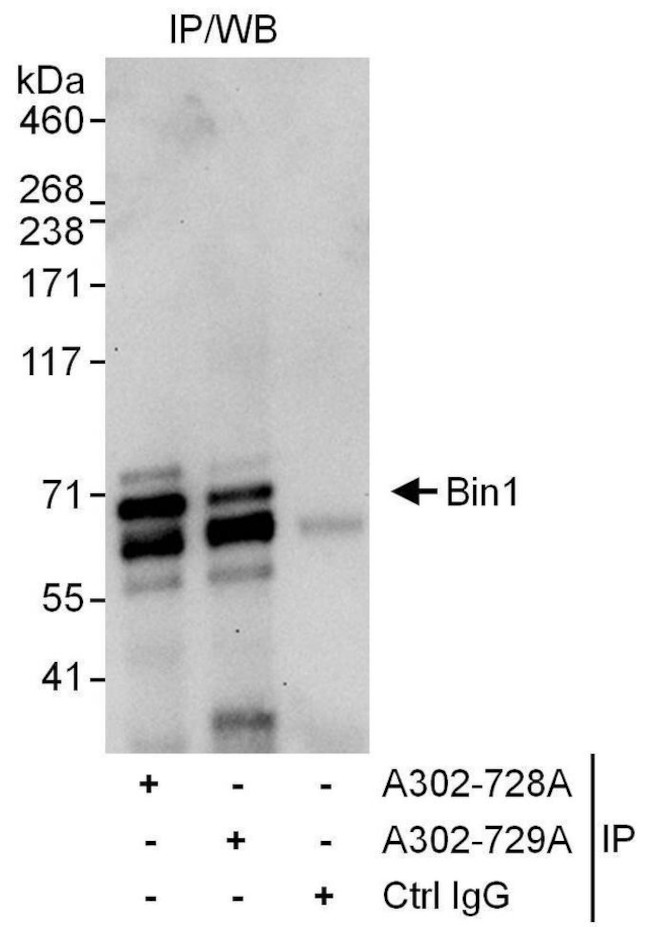 Bin1 Antibody in Immunoprecipitation (IP)