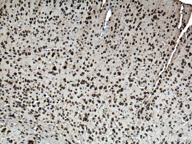 Ataxin 2 Antibody in Immunohistochemistry (Paraffin) (IHC (P))