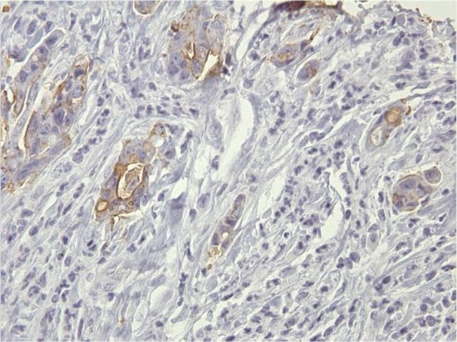 Blood Group A Antigen Antibody in Immunohistochemistry (Paraffin) (IHC (P))