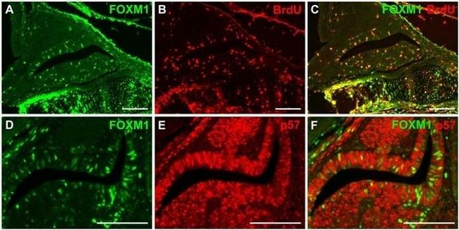 BrdU Antibody in Immunohistochemistry (IHC)