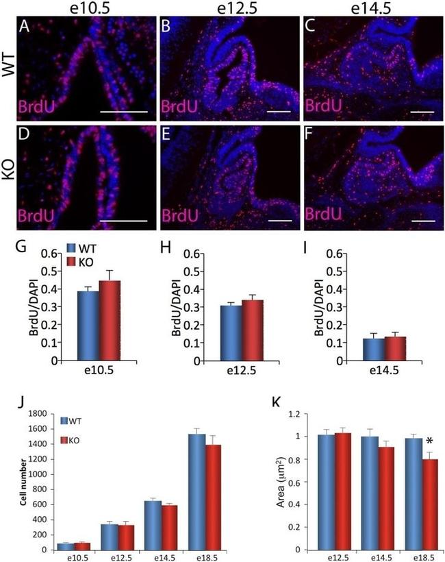 BrdU Antibody in Immunohistochemistry (IHC)