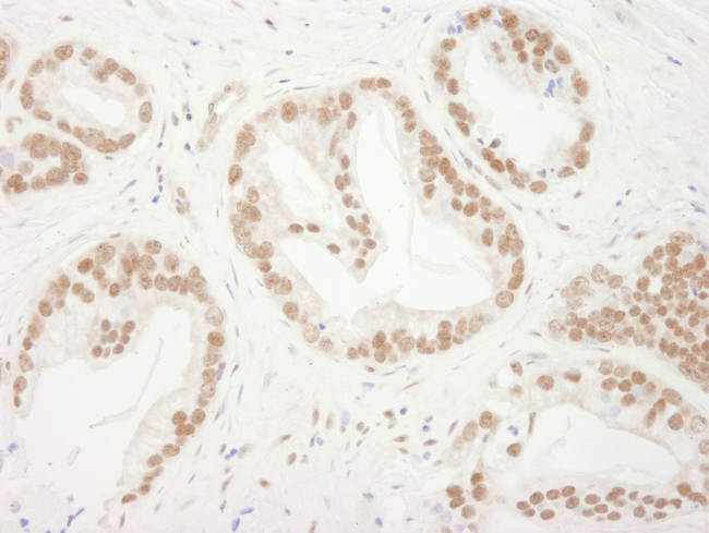 Bub3 Antibody in Immunohistochemistry (IHC)