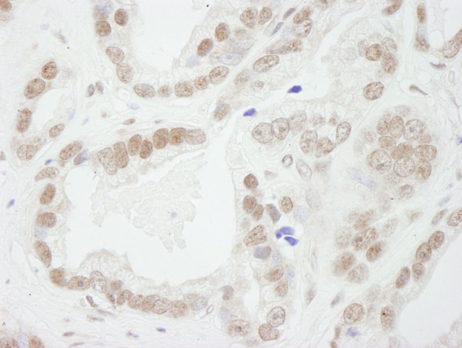 Bub3 Antibody in Immunohistochemistry (IHC)