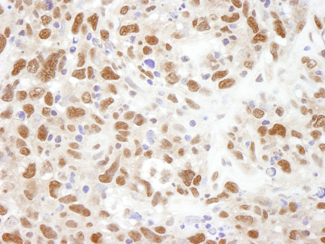 Bub3 Antibody in Immunohistochemistry (IHC)