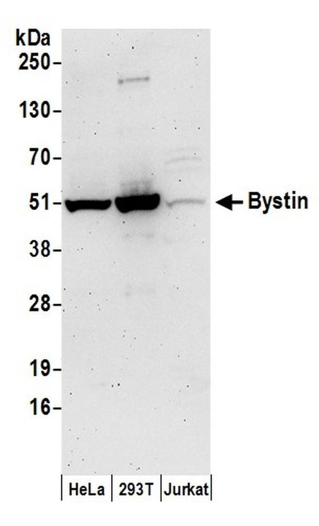 Bystin Antibody in Western Blot (WB)