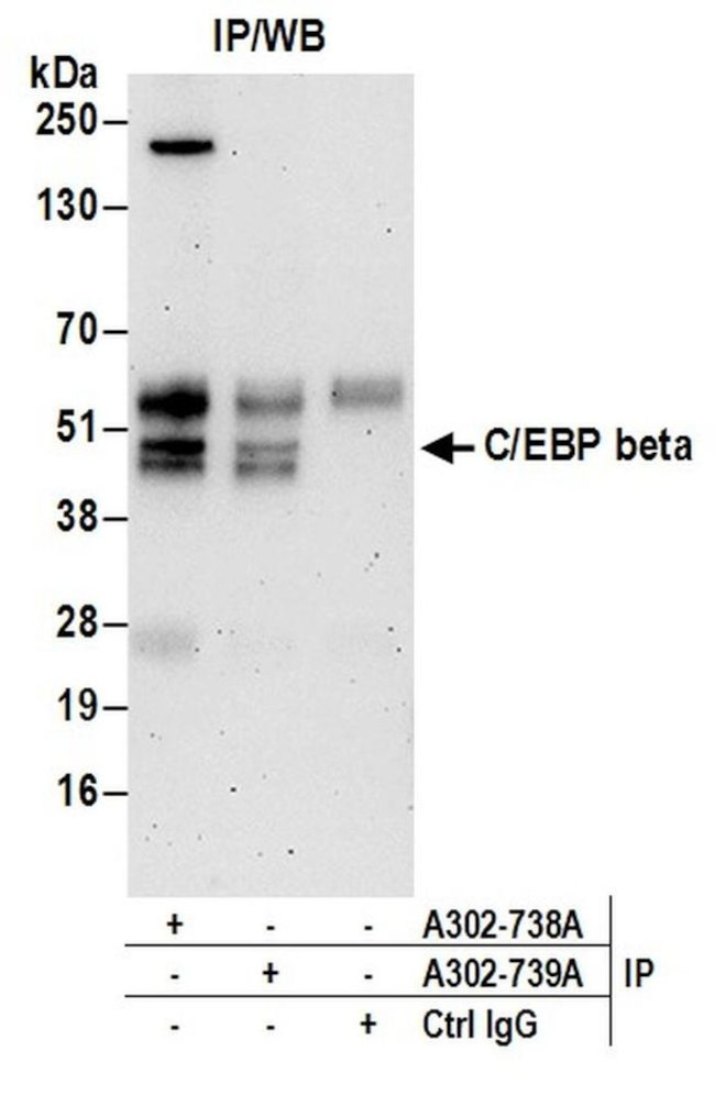 C/EBP beta Antibody in Immunoprecipitation (IP)