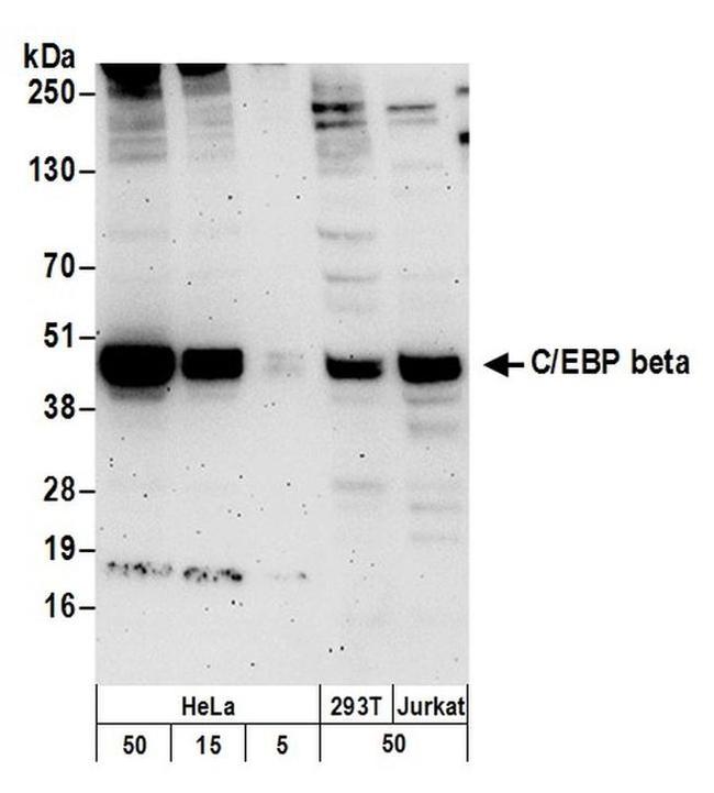 C/EBP beta Antibody in Western Blot (WB)