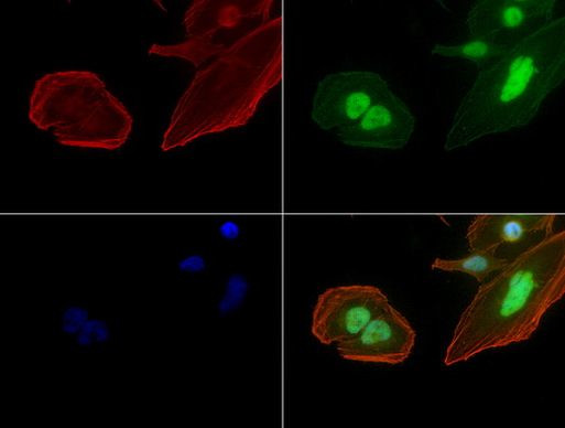 C-Jun Antibody in Immunocytochemistry (ICC/IF)