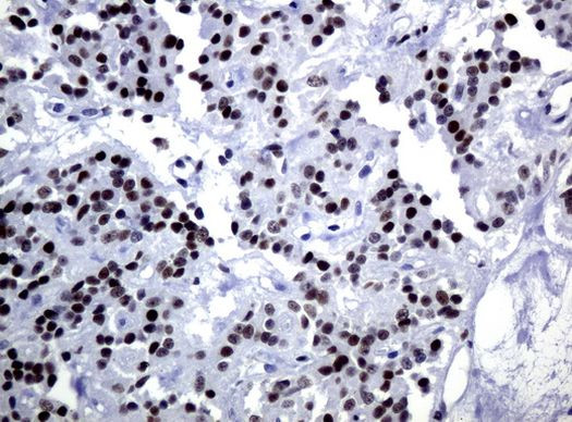 C-Jun Antibody in Immunohistochemistry (Paraffin) (IHC (P))