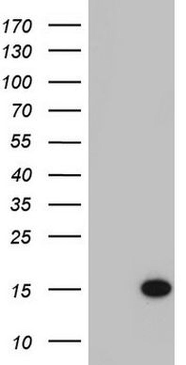 C11orf67 Antibody in Western Blot (WB)