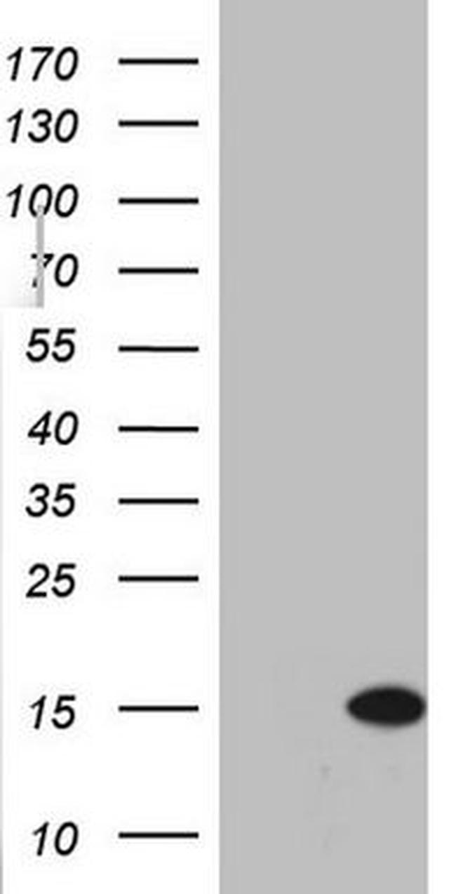 C11orf67 Antibody in Western Blot (WB)