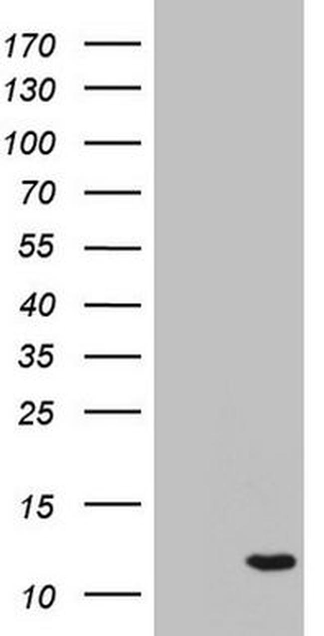 C11orf67 Antibody in Western Blot (WB)