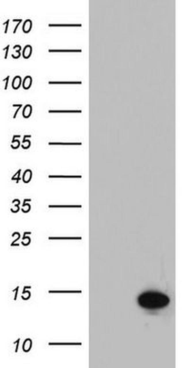 C11orf67 Antibody in Western Blot (WB)