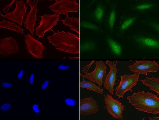 RTRAF Antibody in Immunocytochemistry (ICC/IF)