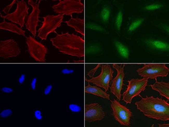 RTRAF Antibody in Immunocytochemistry (ICC/IF)