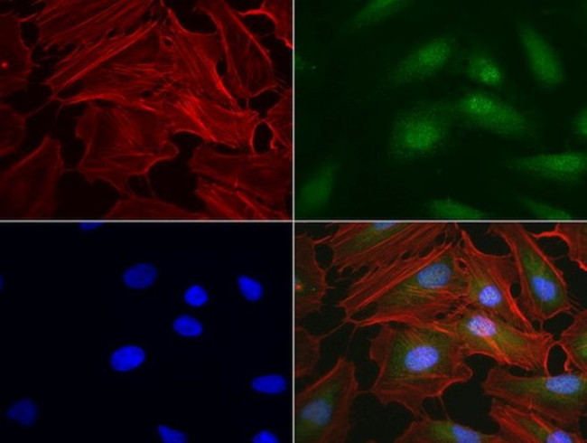 RTRAF Antibody in Immunocytochemistry (ICC/IF)