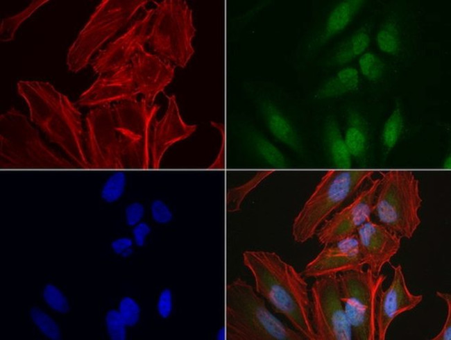 RTRAF Antibody in Immunocytochemistry (ICC/IF)